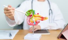 Makanan Sehat Efektif Mencegah Batu Empedu Cepat