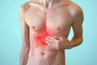 Ilustrasi seseorang memegang perut karena asam lambung naik