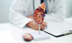 Jangan Abaikan Wajah Pucat, Bisa Tanda Gangguan Ginjal