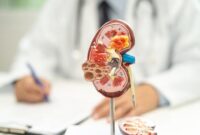 Ilustrasi menunjukkan organ ginjal dan area yang berpotensi mengalami kanker ginjal pada tubuh manusia