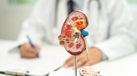 Ilustrasi menunjukkan organ ginjal dan area yang berpotensi mengalami kanker ginjal pada tubuh manusia