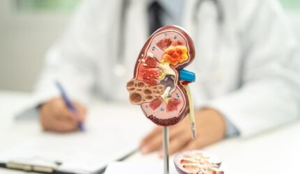 Ilustrasi ginjal manusia dengan penanda area yang terdampak kanker